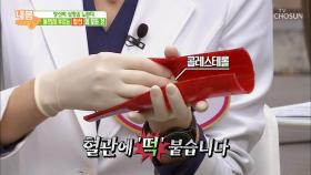 당신의 심장을 노린다! 돌연사를 부르는 ‘혈전’의 정체는?