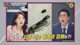 피부 노화 막는 골든타임, 봄철 피부를 사수하라!_내 몸 플러스 139회 예고