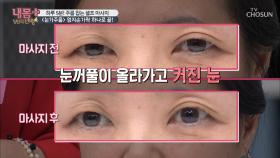 ※노화의 상징※ 주름→부종 잡는 ‘꼬집기’ 마사지