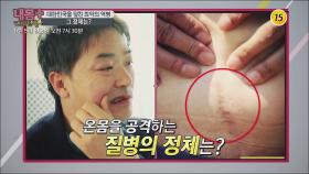 대한민국을 덮친 최악의 역병 그 정체는?_내 몸 플러스 143회 예고