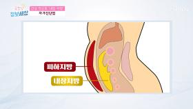 ‘비만’ 자가진단 방법은? 생명의 위협 신호 예방!