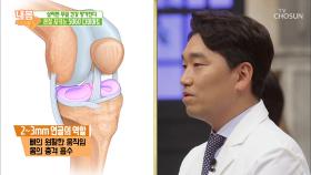 ‘비만’이 관절 건강에 미치는 영향은?