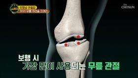 퇴행성 관절염 3mm ‘무릎 쿠션’을 지켜라