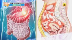 장기를 공격하는 독 중성지방_내 몸 사용설명서 273회 예고