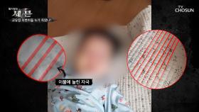 얼굴·가슴에 강한 압박으로 질식사했을 가능성 有