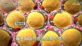 ‘이것’으로 지방세포↗ 관절염·염증↗ #광고포함| TV CHOSUN 20201102 방송