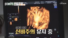 9개월 내내 ‘신비주의’ 유지하는 『엉또』| TV CHOSUN 20201222 방송