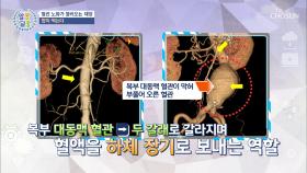 ˹혈관 노화˼가 불러오는 치명적인 질병 TOP 3 TV CHOSUN 20210506 방송