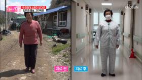 ‘고주파 정맥 폐쇄술’로 달라진 엄마의 상태❣ TV CHOSUN 20210509 방송