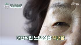 뿌옇게 안개 낀 거 같은.. 대표적 노안 질환 ˹백내장˼ TV CHOSUN 20210717 방송