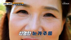 달달한 음식 러버🍫🍰 그녀의 식습관이 불러온 피부 노화😨 TV CHOSUN 240427 방송