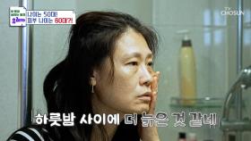 갱년기 이후🧒🏻 급속도로 찾아온 노화가💢 고민인 중년 여성😩 TV CHOSUN 241020 방송