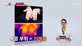 추운 겨울날🥶 심해지는 통증의💥 이유는 저체온?!😱 TV CHOSUN 241108 방송