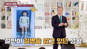 죽음의 마을이 된 온산...? 무분별한 개발이 불러온 비극😨 TV CHOSUN 241117 방송