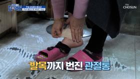 심각한 관절 통증💥 진통제와 파스 없이는 살 수 없는 주인공😰 TV CHOSUN 241210 방송