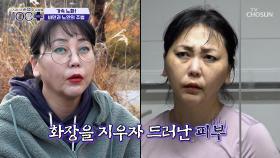 가속 노화를 막기 위해 노력을 하지만 무색해지는 결과💥 TV CHOSUN 241221 방송