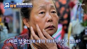 급격한 피부 노화로 기미가 가득 찬 그녀의 얼굴😨 TV CHOSUN 250817 방송