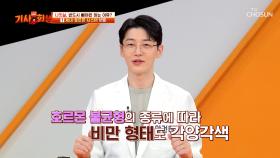 점점 늘어나는 체중😫 중년 여성들의 건강을 위협하는 나잇살💥 TV CHOSUN 251013 방송