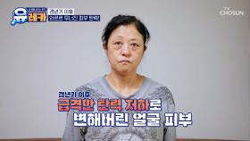 갱년기 이후 아무리 노력해도 점점 처지는 그녀의 피부😱 TV CHOSUN 250914 방송