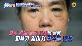 겨울철! 중년의 피부 관리법_내 몸을 살리는 유레카 225회 예고 TV CHOSUN 251130 방송