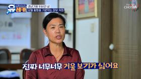 밖에 나가기가 싫어요😔 그녀의 자신감 뚝⬇ 떨어뜨리는 피부 고민 TV CHOSUN 251130 방송